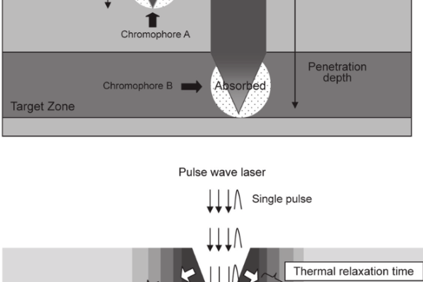 1 – Selective Photothermolysis (MelaninHemoglobin Targets 1 - Selective Photothermolysis (MelaninHemoglobin Targets