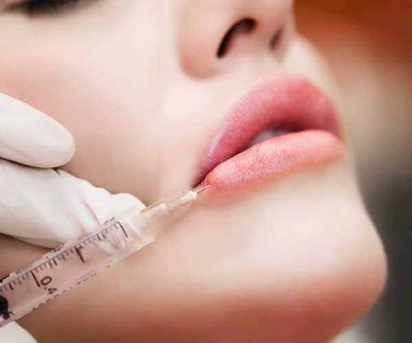 1 - Swelling Timeline, 2-Week Review, Avoiding2-Week Review, Avoiding MigrationOverfil