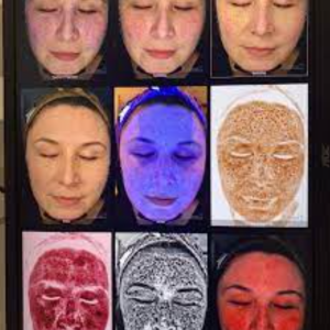 1 - Why Choose Our Calgary 3D Scanning Clinic