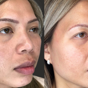 2 - Before & After and How Long They Last