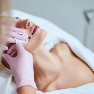 2 – RF Microneedling Short-Term Redness and Flakin 2 - RF Microneedling Short-Term Redness and Flakin