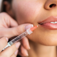 2 - Swelling Timeline, 2-Week Review, Avoiding2-Week Review, Avoiding MigrationOverfil