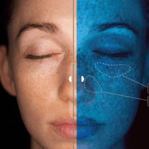 2 - Why Choose Our Calgary 3D Scanning Clinic