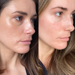 3 - Before & After and How Long They Las
