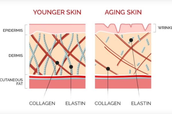 3 – CollagenElastin Stimulatio 3 - CollagenElastin Stimulatio
