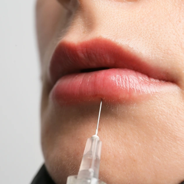 3 - Injection (NeedleCannula, Microinjections