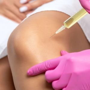 4 – PRP & Injectables Managing Swelling and Bruisin 4 - PRP & Injectables Managing Swelling and Bruisin