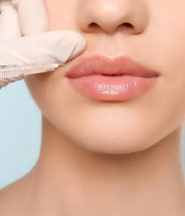 4. ) Calgary Lip Fillers 4. ) Calgary Lip Fillers