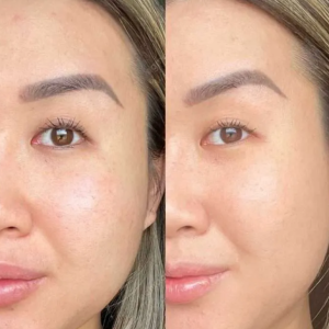 5 - Before & After and How Long They Last