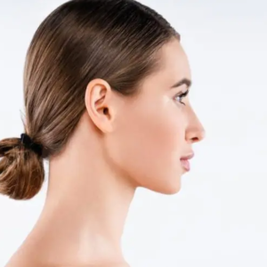 5 - Chin and Jawline Filler for Profile Balancin