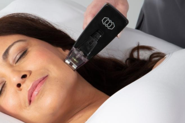 5 - RF microneedling (Morpheus8) and RF tighteningRFAL