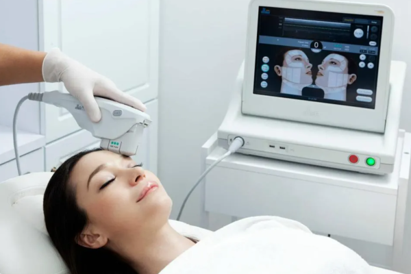 6 – Ultherapy ultrasound lifting 6 - Ultherapy ultrasound lifting