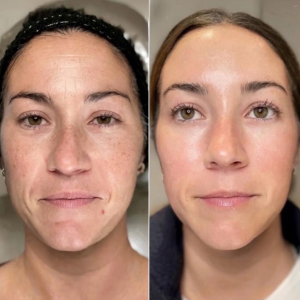 7 - Before & After and How Long They Last
