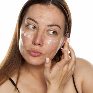 A Step-by-Step Guide to Your Melasma Car