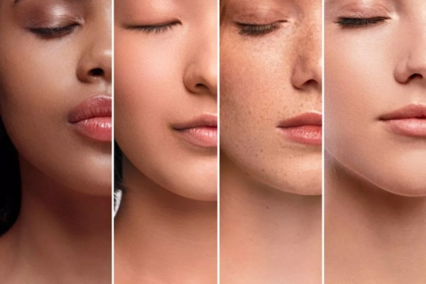Combination Approaches tailored to subtype and skin ton Combination Approaches tailored to subtype and skin ton
