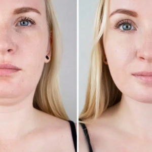 Combining Treatments for theTreatments for the Best Jawli]