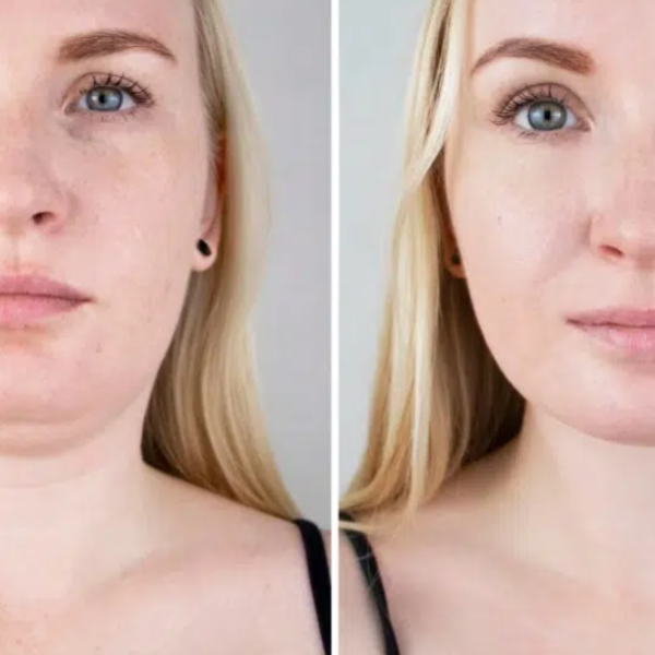 Combining Treatments for theTreatments for the Best Jawli]