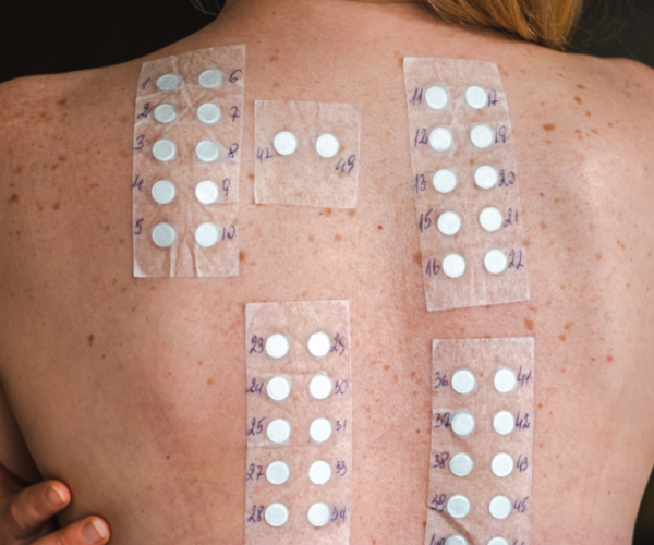 Consultation & Skin Analysis (patch test)