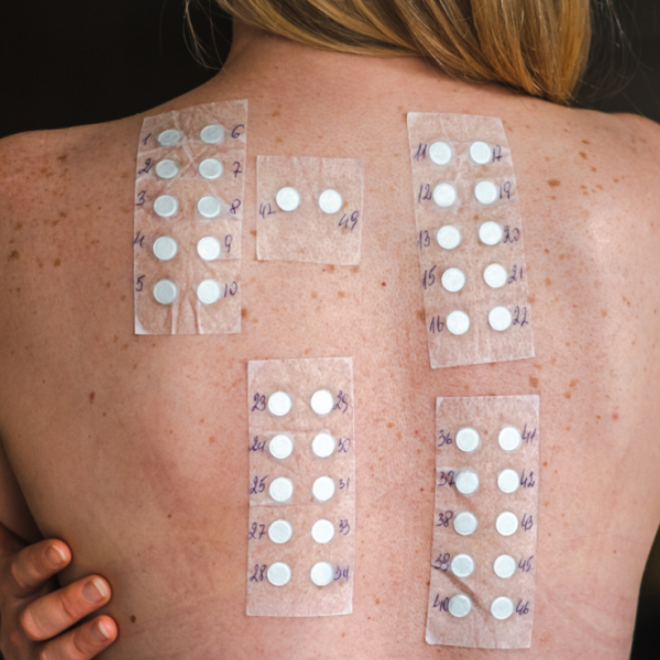 Consultation & Skin Analysis (patch test)