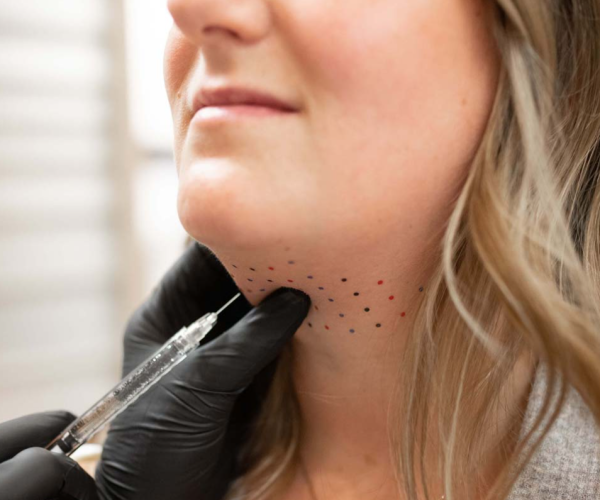 Double Chin Beylkra
