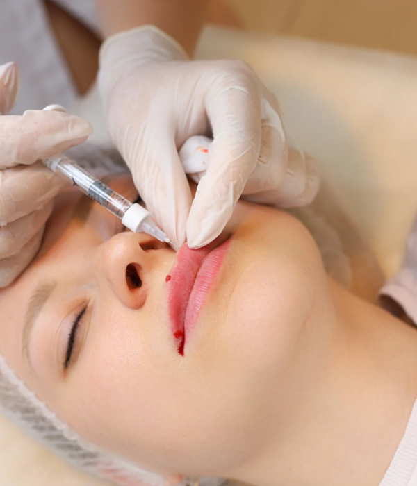 Health Canada-Licensed Fillers and Safety Standards Health Canada-Licensed Fillers and Safety Standards