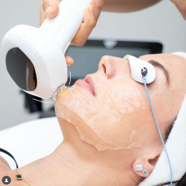 Our Devices Cynosure Icon MaxG, Lumecca IPL (InMode) & ResurF Our Devices Cynosure Icon MaxG, Lumecca IPL (InMode) & ResurF