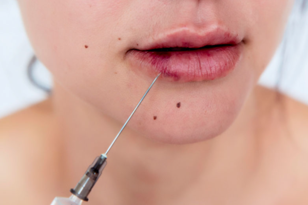 PIH, burns (energy devices), nodules (biostimulators), vascular occlusion (fillers PIH, burns (energy devices), nodules (biostimulators), vascular occlusion (fillers