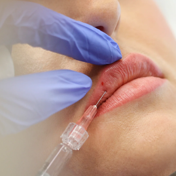 Pain Management Topical Numbing + Lidocaine in GelTopical Numbing + Lidocaine in Gel Pain Management Topical Numbing + Lidocaine in GelTopical Numbing + Lidocaine in Gel