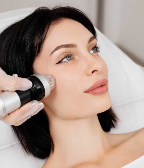 RF Microneedling (Sylfirm X) and Microneedling with Drug