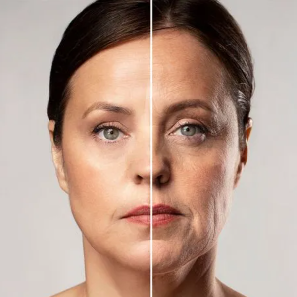 Skin Laxity, timelines, and treatment