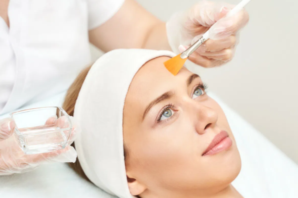 Superficial Chemical Peels Superficial Chemical Peels