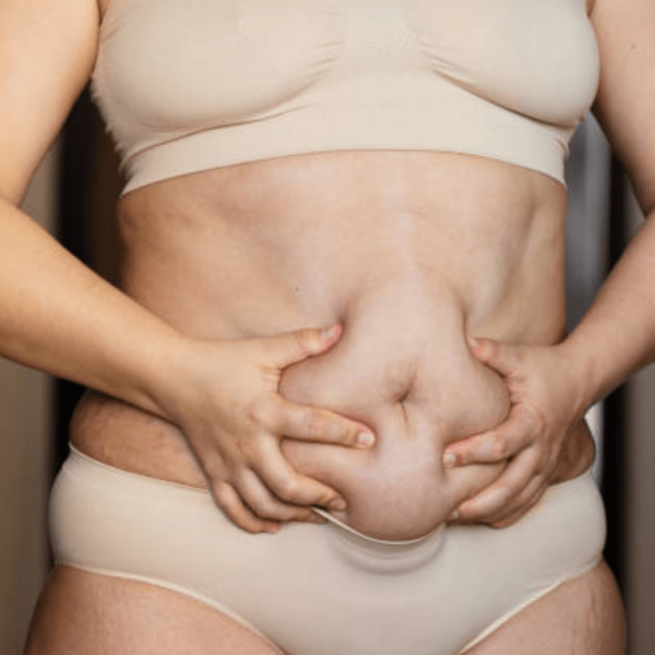 Weight Loss, Postpartum, Genetics &Postpartum, Genetics & Hormone Weight Loss, Postpartum, Genetics &Postpartum, Genetics & Hormone