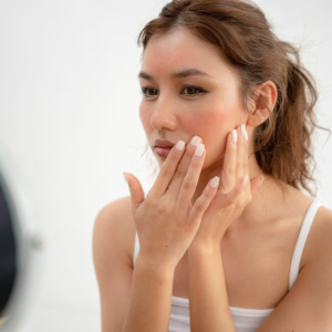 What Is Sun Damage (Photodamage