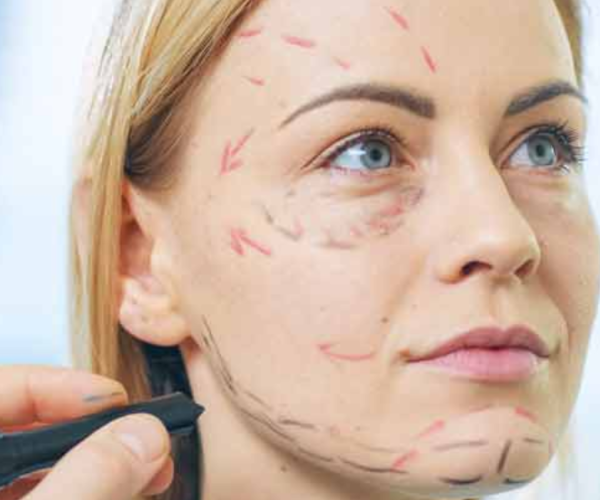 When SMAS Surgical Lifting Is MoreSurgical Lifting Is More Appropriat When SMAS Surgical Lifting Is MoreSurgical Lifting Is More Appropriat