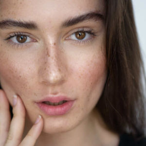 after - Sun Spots