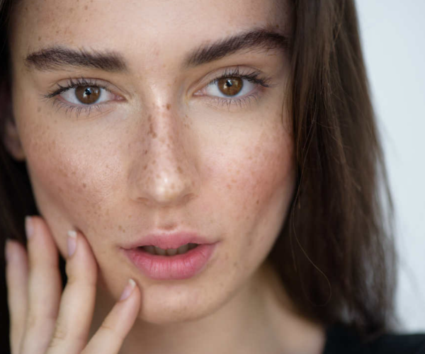 after – Sun Spots after - Sun Spots
