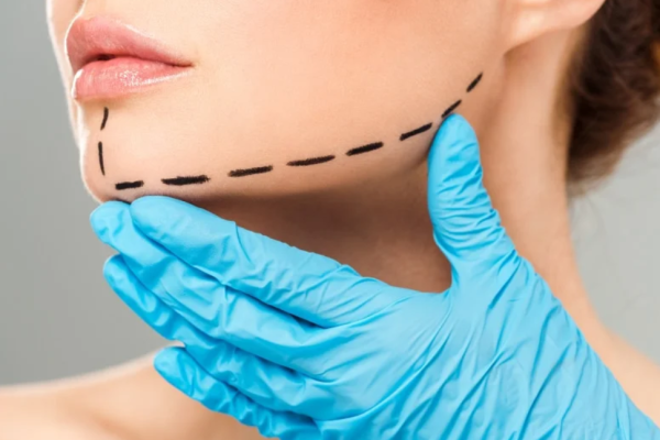 chin lipo